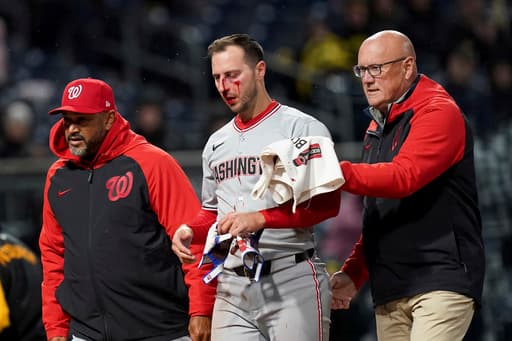Nats’ Paul DeJong relieved his vision wasn’t affected by pitch to face that broke multiple bones