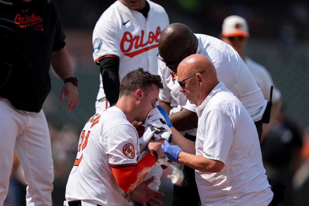 Orioles catcher James McCann shrugs off fastball to face, stays in game after being bloodied